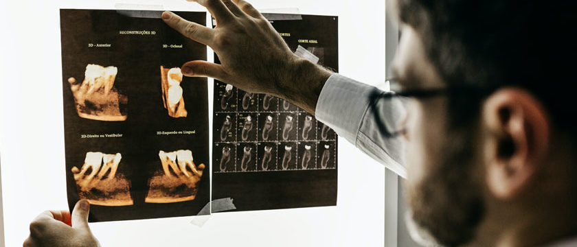 radiographie dentaire