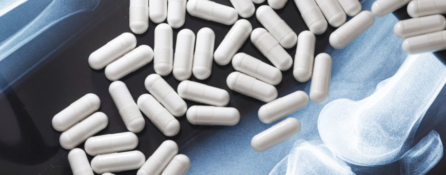 Les compléments alimentaires anti-arthrose